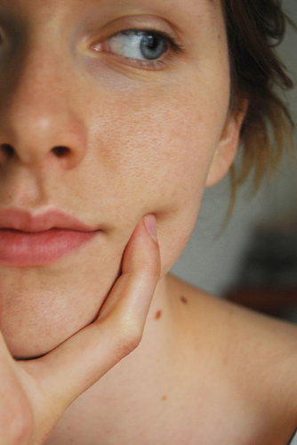 了解您的痣！痣的位置代表什麼意思？