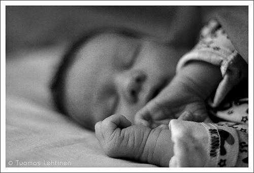 嬰兒頭型矯正方式為何? 要怎麼睡才能睡出好頭型