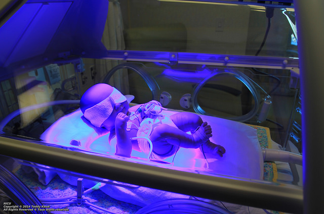 寶寶黃疸指數過高怎麼辦 多久會退