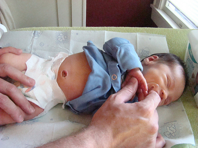 新生兒臍帶護理多久會掉或脫落