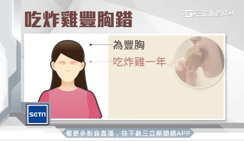 吃炸雞豐胸? 少女連吃一年只胖了20公斤