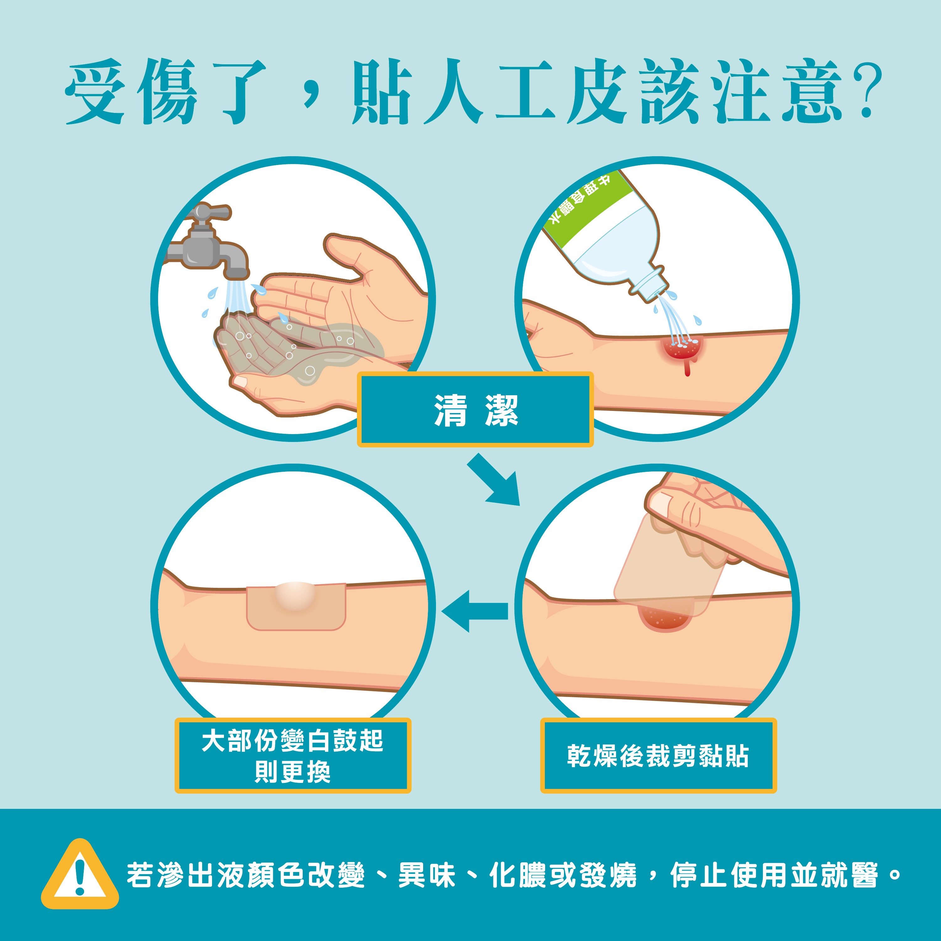 人工皮更換時機 多久換一次才比較好