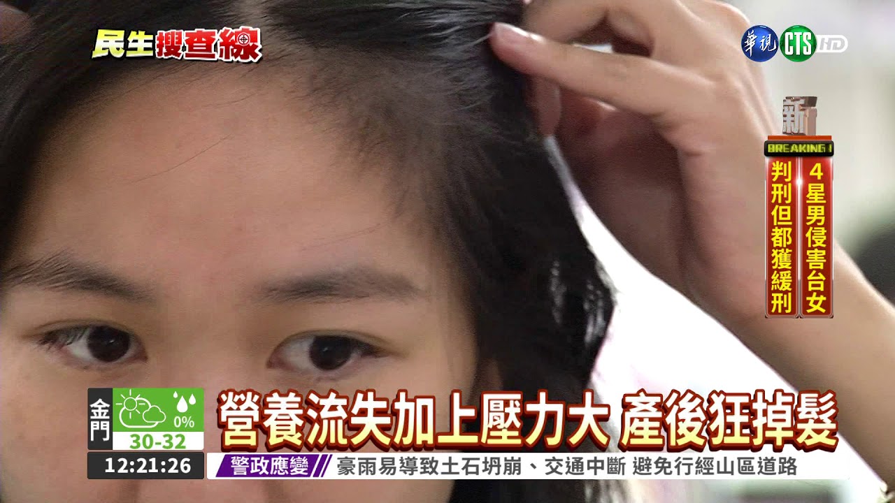 生產後掉髮嚴重怎麼辦? 吃對食物就能改善