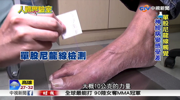 糖尿病神經病變症狀 沒痛覺要留意