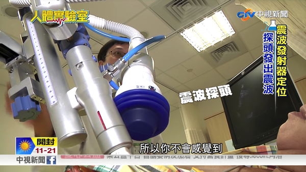 心絞痛 治療利器 心臟體外震波