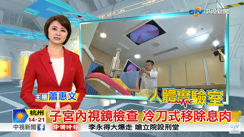 子宮內視鏡冷刀息肉切除術