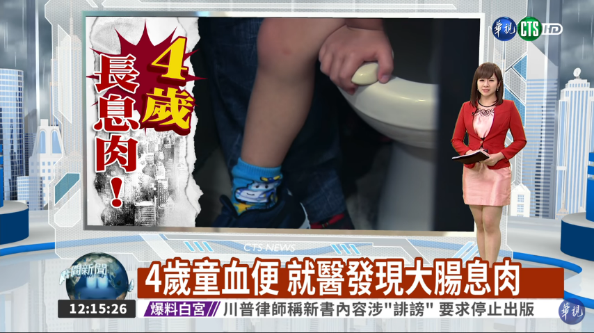 小孩血便原因?! 一名四歲童血便就醫後診斷出大腸息肉 1 小孩血便原因?! 一名四歲童血便就醫後診斷出大腸息肉