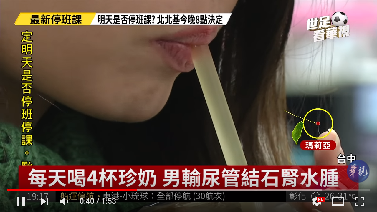 男大生一天四杯珍奶 竟罹患輸尿管結石