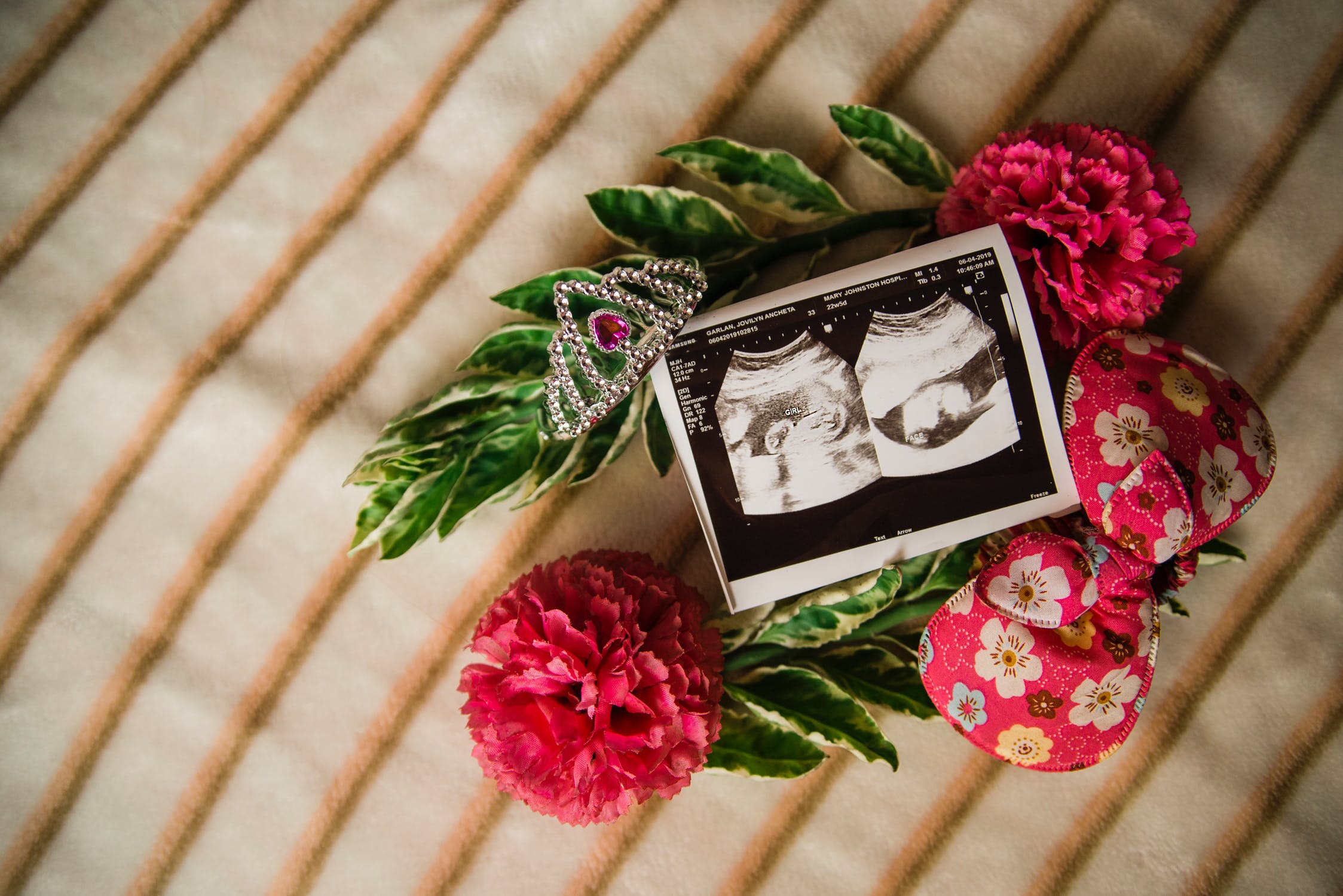 胎動是什麼感覺?會痛嗎? 1 胎動的感覺是什麼 會痛嗎?